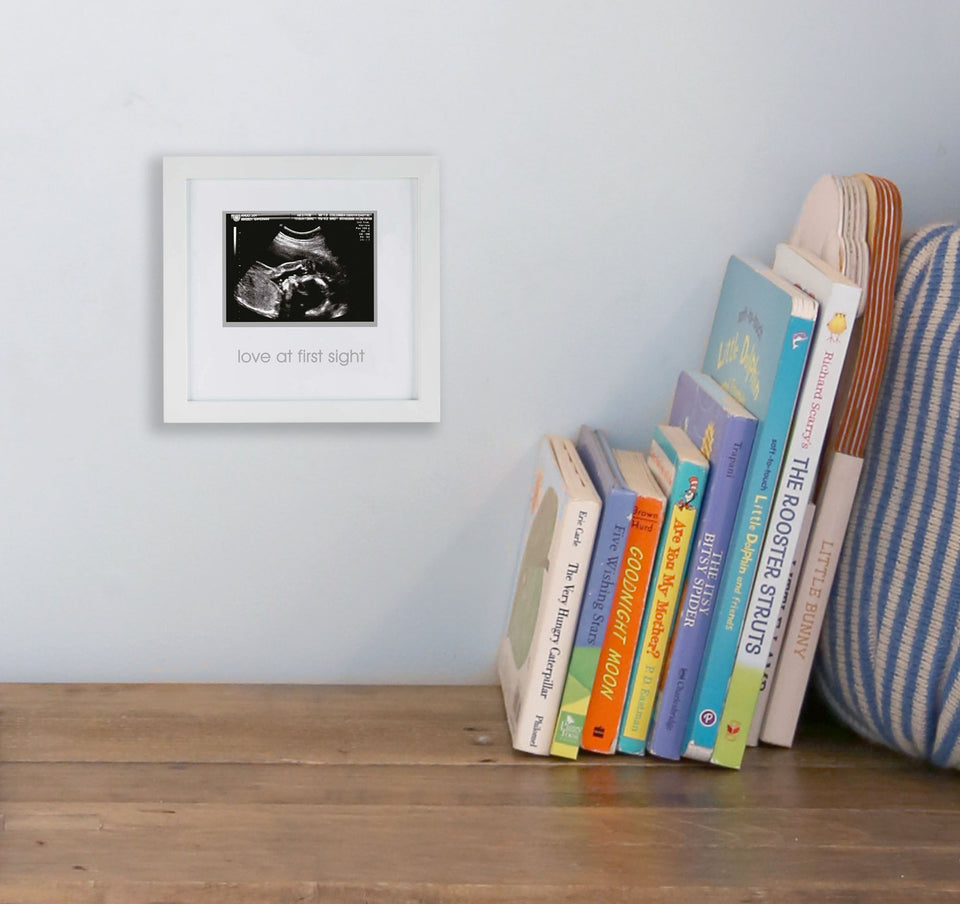 Pearhead Love at First Sight Sonogram Keepsake Frame, Baby Ultrasound, White - Premium Baby Wall Decor from Pearhead - Just $22.84! Shop now at Kis'like